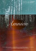 Amnion