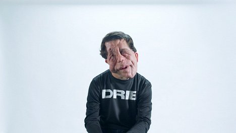 Adam Pearson - DRIB - De la película