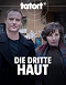 Tetthely - Die dritte Haut