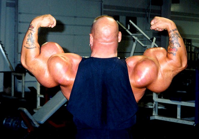 The Man Whose Arms Exploded - Photos
