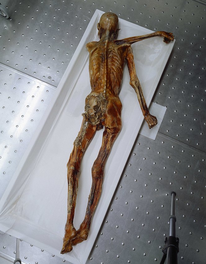 Iceman Autopsy - Photos