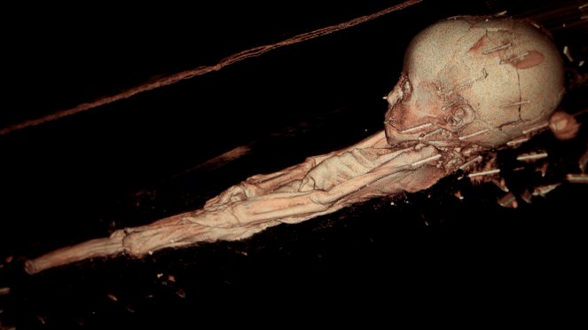 Coptic Mummies of Antinoopolis - Photos