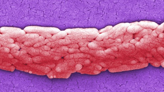 Die großen Epidemien - Filmfotos