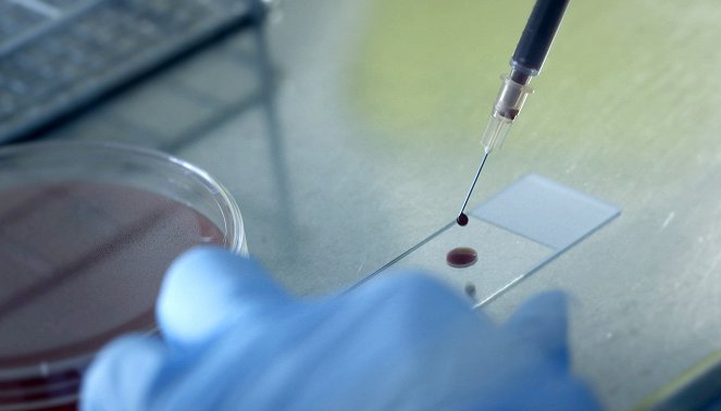 OP gelungen - Patient tot: Lebensgefahr durch neue Krankenhaus-Keime - Filmfotók