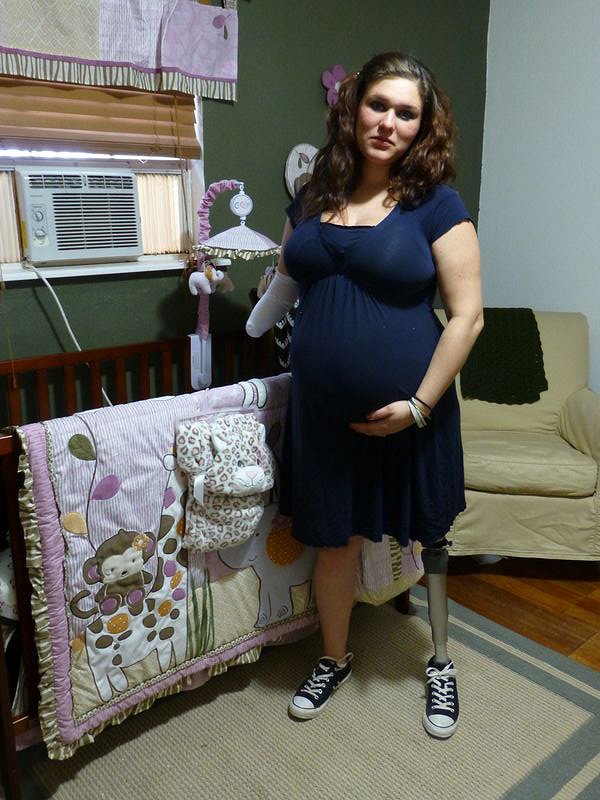 My Extraordinary Pregnancy - Photos