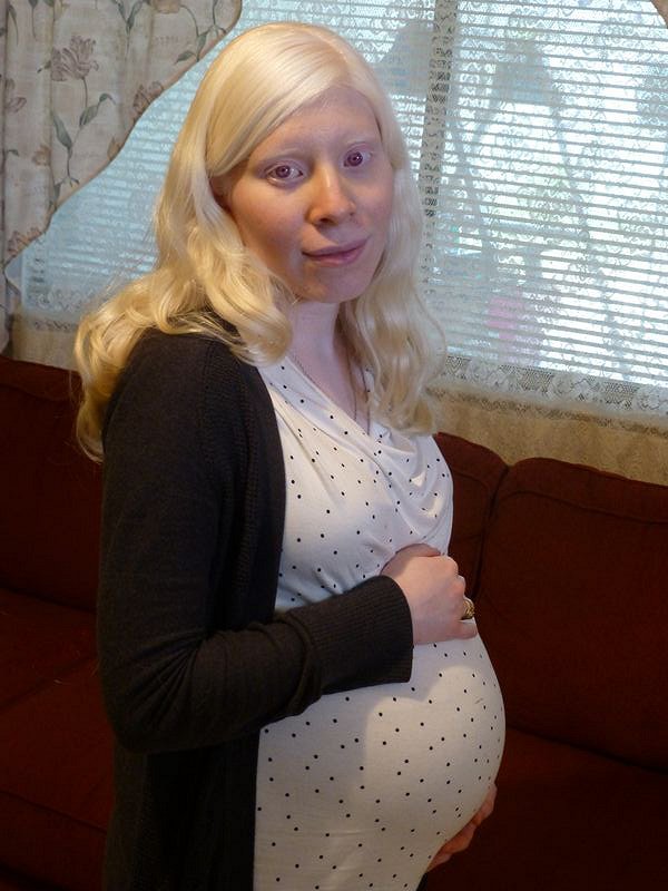 Extraordinary Pregnancies - Photos