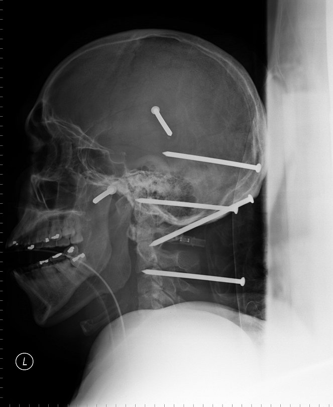 Bizarre E.R. - Photos