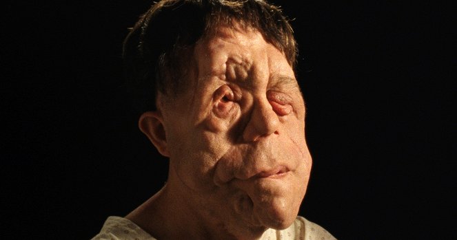 Chained for Life - Do filme - Adam Pearson