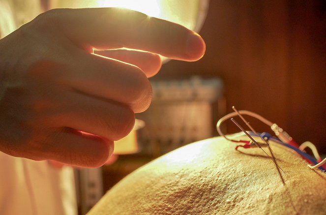 Spitzenmedizin: Akupunktur – Mythos oder Therapie? - De la película