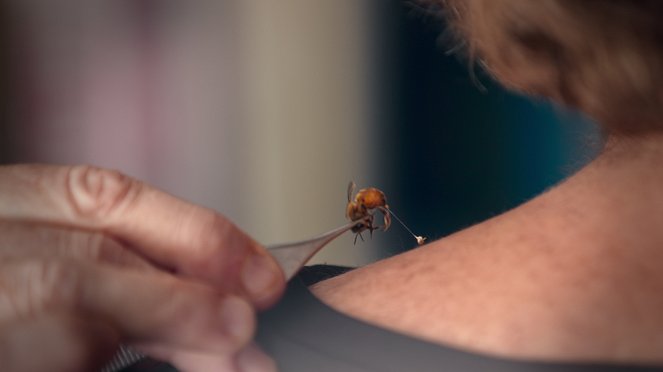 (Un)Well - Bee Sting Therapy - Photos