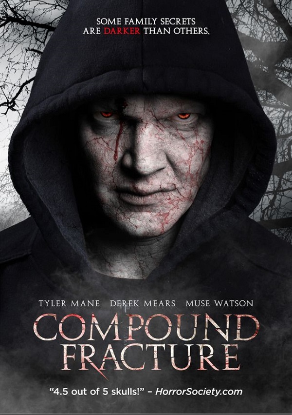 Compound Fracture - Posters