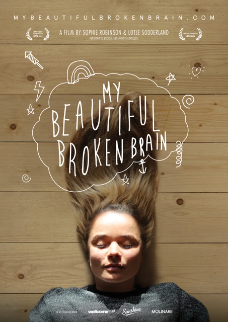 My Beautiful Broken Brain - Plakátok