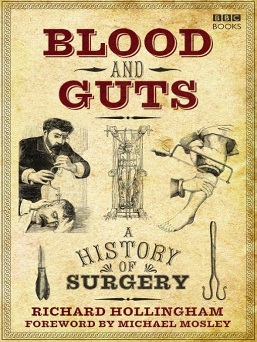 Blood and Guts: A History of Surgery - Affiches