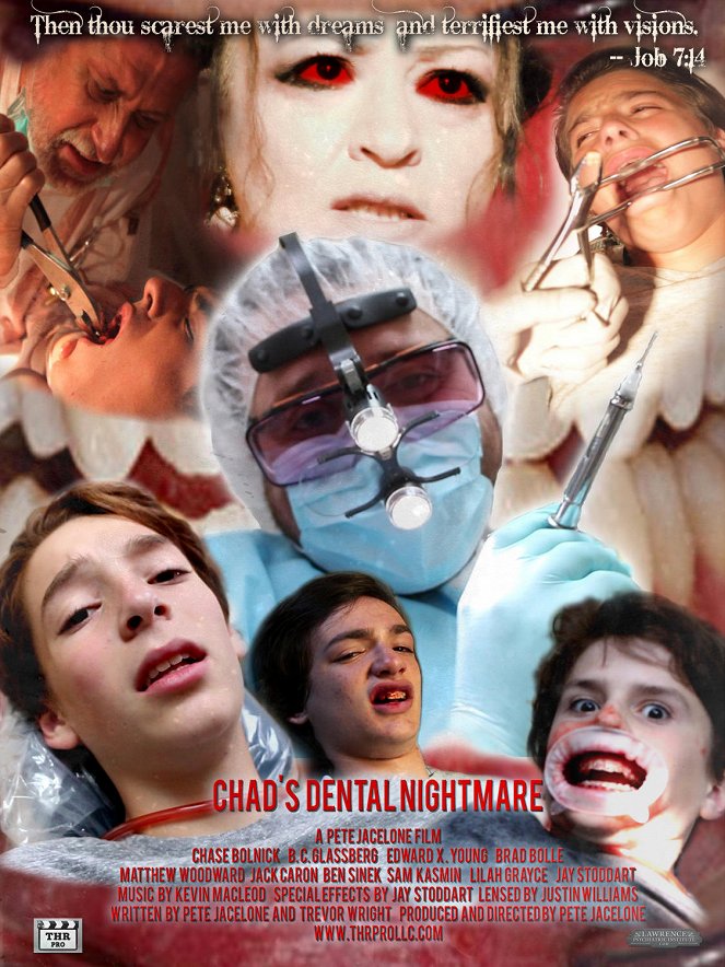 Chad's Dental Nightmare - Julisteet