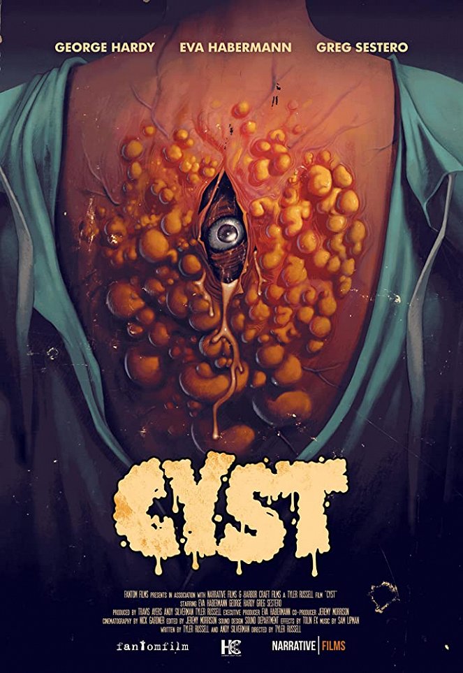 Cyst - Cartazes