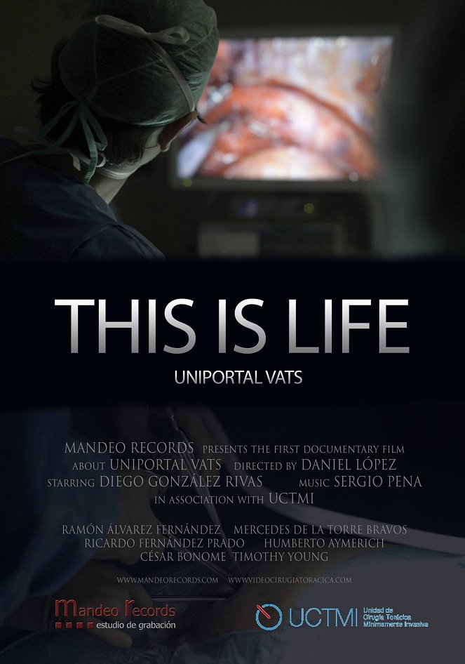 This Is Life-Uniportal Vats - Affiches