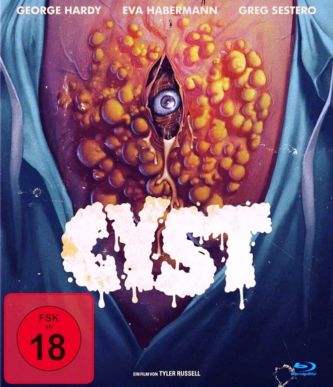 Cyst - Plakate
