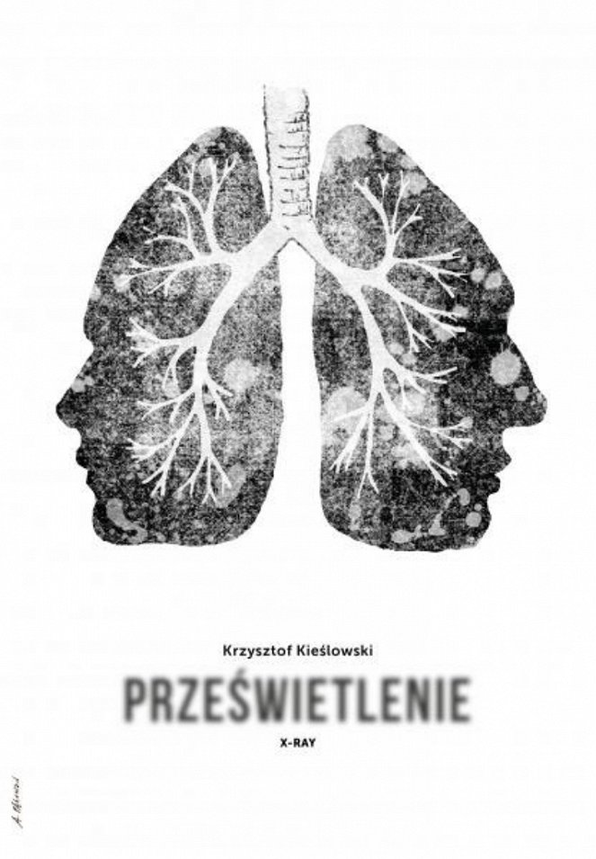 Prześwietlenie - Plakátok