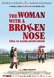 Woman with a Broken Nose, The