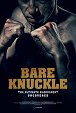 Bare Knuckle