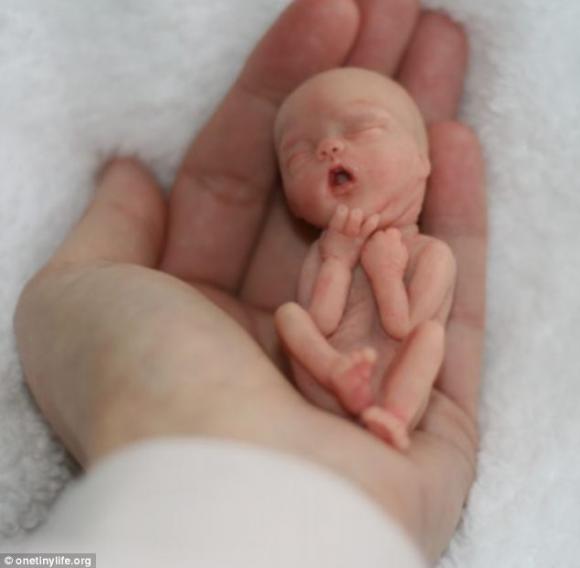 Propagácia potratov pod zámienkou ochrany ľudskej dôstojnosti je cynizmus. (A. Záborská, slovenská poslankyně EP)